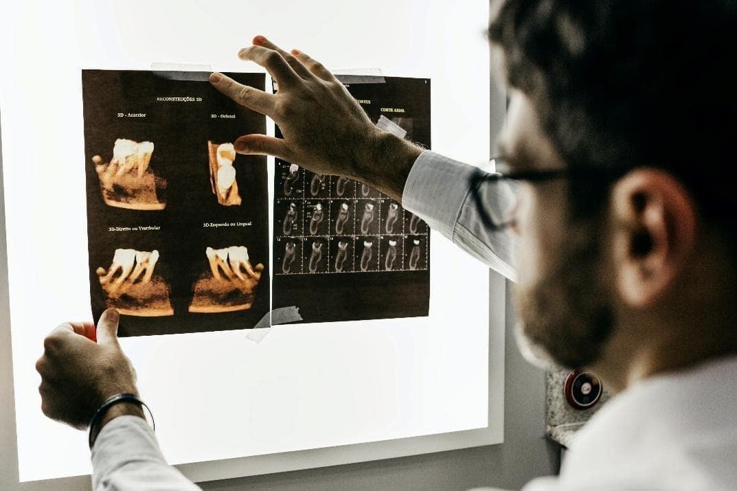 Homem olhando radiografias